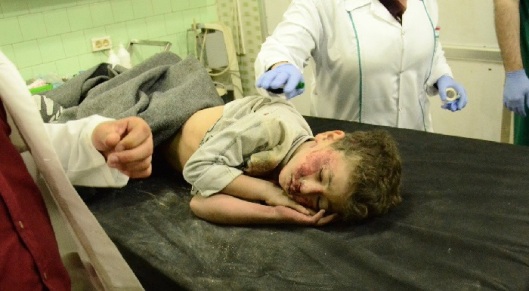 syria-terrorist-attack-kid-20161107